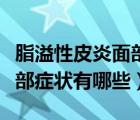 脂溢性皮炎面部的症状有哪些（脂溢性皮炎面部症状有哪些）