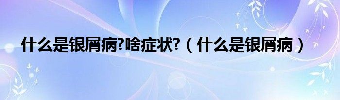 什么是银屑病?啥症状?（什么是银屑病）