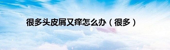 很多头皮屑又痒怎么办（很多）