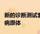 新的诊断测试套件可轻松识别偏远地区的剧毒病原体